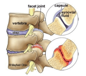 spine